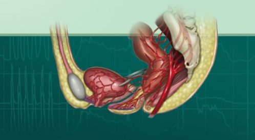 FTC promove curso de iniciação a Fisiologia Anorretal