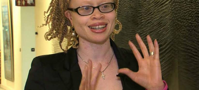 Especialista da ONU discute direitos das pessoas com albinismo na FTC